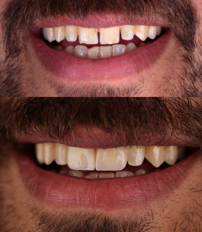 combined-image (1)